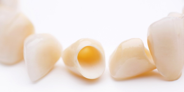 Временные коронки